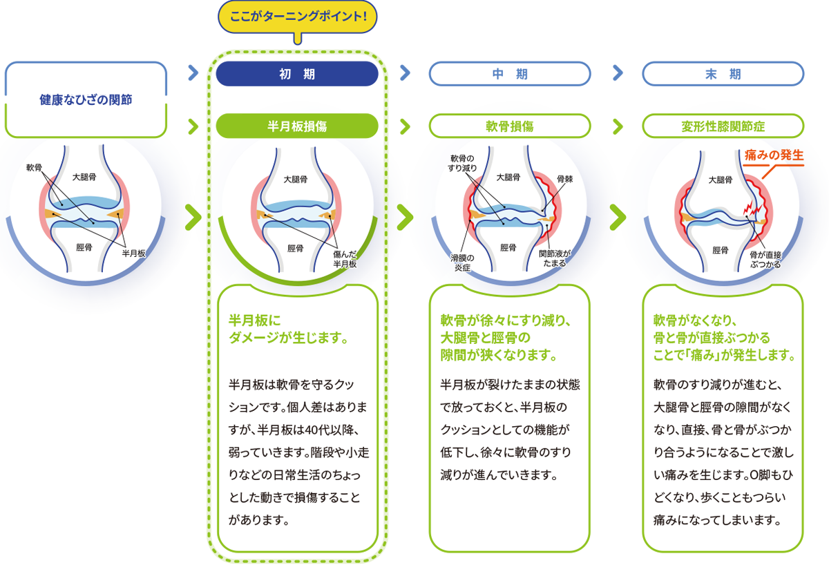 ひざの痛みどうやって起こる？